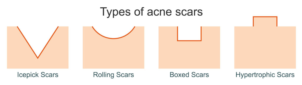 types of scars animated picture