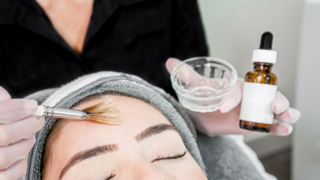Read more about the article Different Types Of Chemical Peels